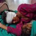 श्रीमानको निर्घात कुटपिटपछि श्रीमतीको कान काटे