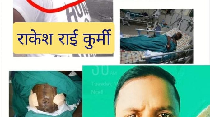 धनुषा : आपसी विवादमा खुकुरी प्रहार, एक जनाको मृत्यु
