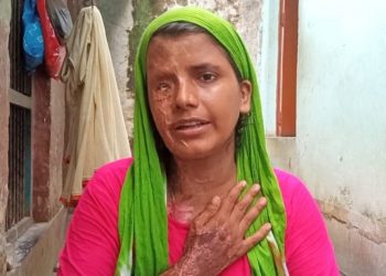 जनकपुर : एसिड बेच्नेलाई सजाय नगरेकामा एसिड पिडित आरतीको आपत्ति
