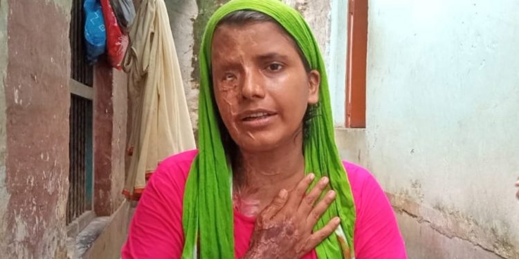 जनकपुर : एसिड बेच्नेलाई सजाय नगरेकामा एसिड पिडित आरतीको आपत्ति