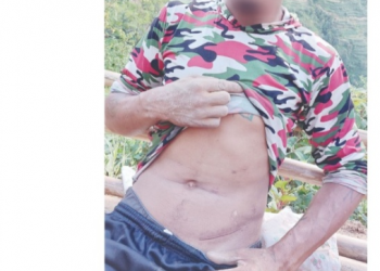नक्कली नागरिकता बनाएर मिर्गाैला (Kidney) तस्करी