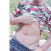 नक्कली नागरिकता बनाएर मिर्गाैला (Kidney) तस्करी
