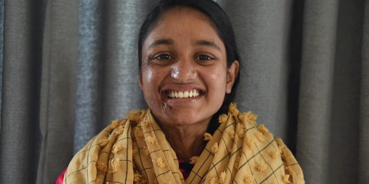प्रदेश २ सरकारले एसिड पीडित मुस्कानलाई थप उपचारको लागी पाँच लाख उपलब्ध गराउने